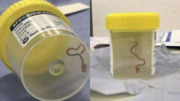 8-cm live parasitic roundworm