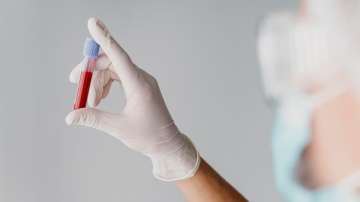 Alzheimer's Blood Tests