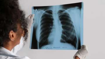 Lung Issue