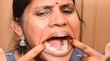 Kalpana shows off her extra teeth