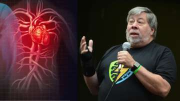 Steve Wozniak, the co-founder of Apple hospitalised in Mexico City, suffers a possible stroke