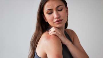 woman suffering from rash