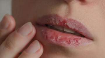 DIY lip scrups Shahnaz Husain