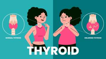 home remedies for Thyroid problems