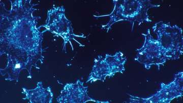Dying Cancer Cells
