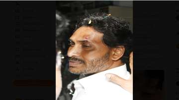 Jagan Mohan Reddy injured, Stones hurled at Jagan Mohan Reddy convoy, Vijayawada, election campaigni