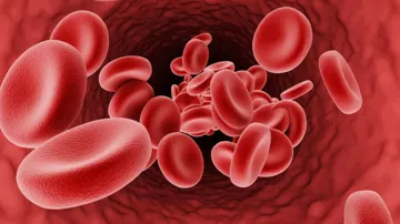 thalassemia capital of the world