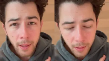 nick jonas apologises