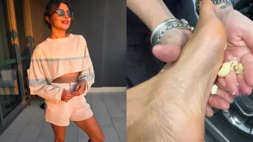 Priyanka Chopra rubs garlic on feet