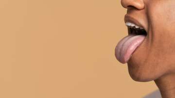 Tongue colours can indicate some serious diseases