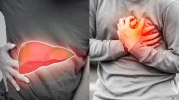 Know whether fatty liver can cause a heart attack or not