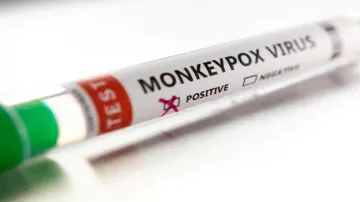 Monkeypox virus