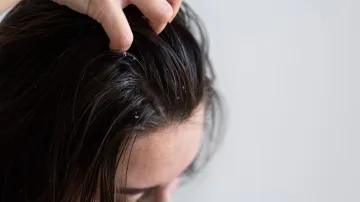 Tips to prevent itchy scalp during monsoon