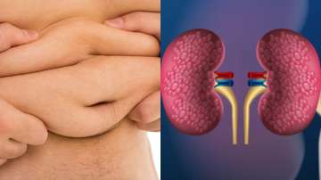 Know how excess weight affects your kidneys