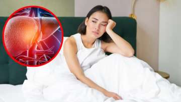 Sleep deprivation can lead to liver damage