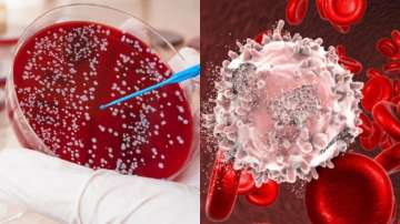 5 early symptoms of blood cancer