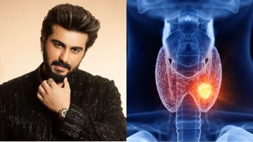 Arjun Kapoor, Hashimoto’s disease