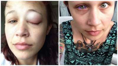 Amber Luke reveals she went BLIND after getting blue tattoos on her  eyeballs  Daily Mail Online