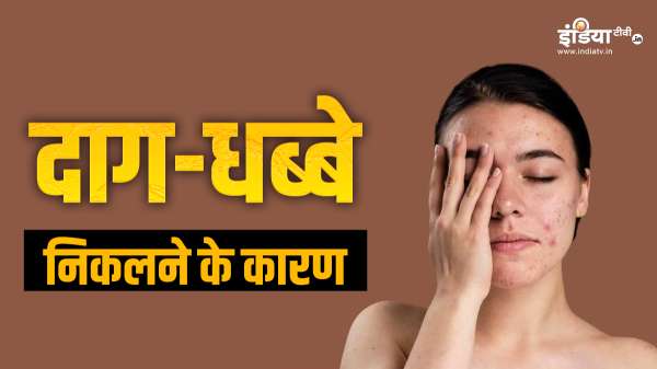 चेहरे पर निकलते रहते हैं काले रंग के दाग-धब्बे, जान लीजिए इस समस्या के पीछे के कारण