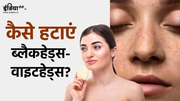 ब्लैकहेड्स-वाइटहेड्स की समस्या का रामबाण इलाज, हटाने के लिए इन चीजों को कर सकते हैं अप्लाई