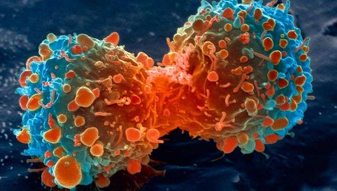 'Cancerous tumours can be treated in just two hours with