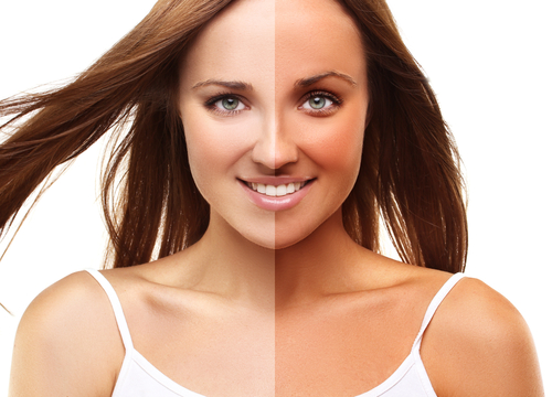 Sunburn can be treated with dairy products. These 5 tips