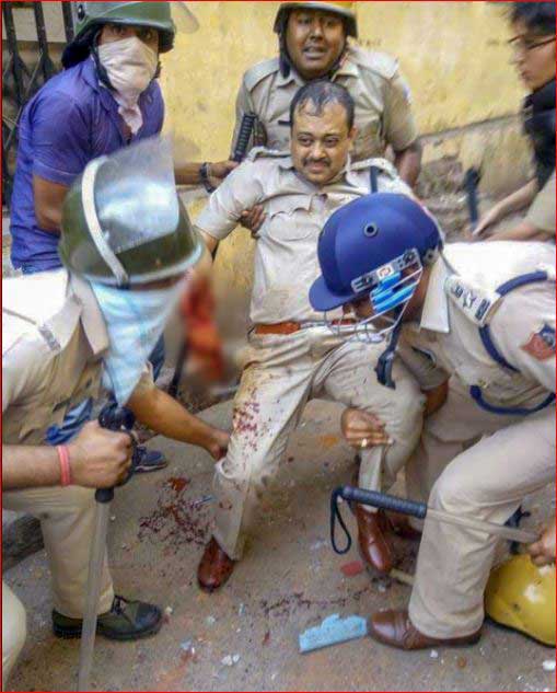 India Tv - An injured  police officer in Raniganj