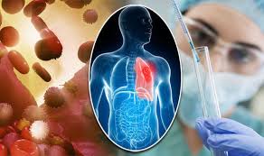 Scientists develop new technique to fine-tune cancer