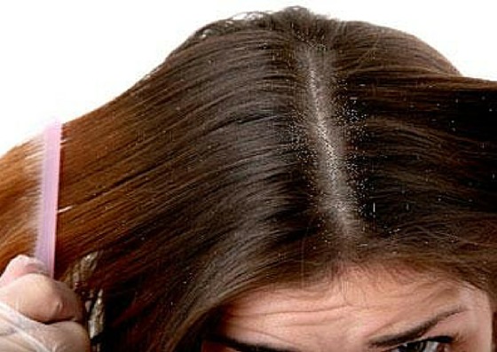 5 most common hair problems with easy and effective ...