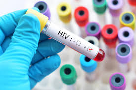 Nearly 40 individual HPV types linked to HIV infection: