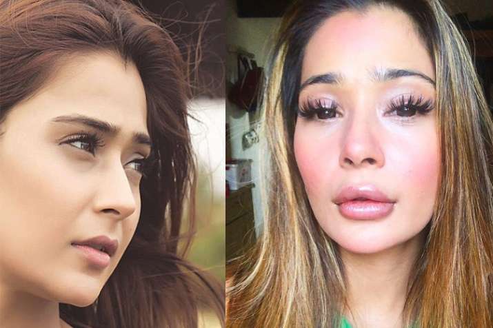 Bigg Boss fame Sara Khan on people trolling her over lip surgery