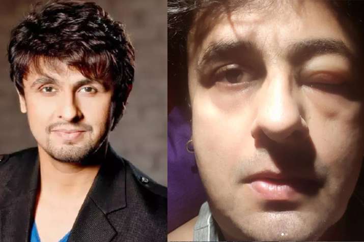 Sonu Nigam Heroine Ka Sexy Xxx Video - Sonu Nigam shares his pic from the ICU of a hospital, thank fans ...