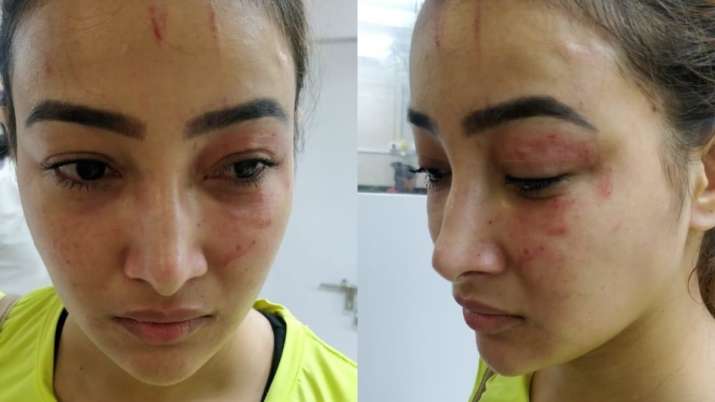 India Tv - Naamkaran actress Nalini Negi files FIR against roommate Preeti Rana and her mother for brutally beating herÂ 