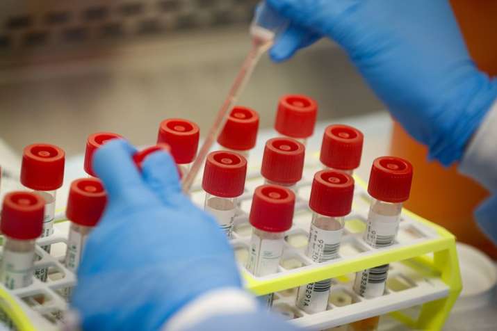 Coronavirus in Karnataka: 3 more positive cases confirmed, takes total to 18 cases