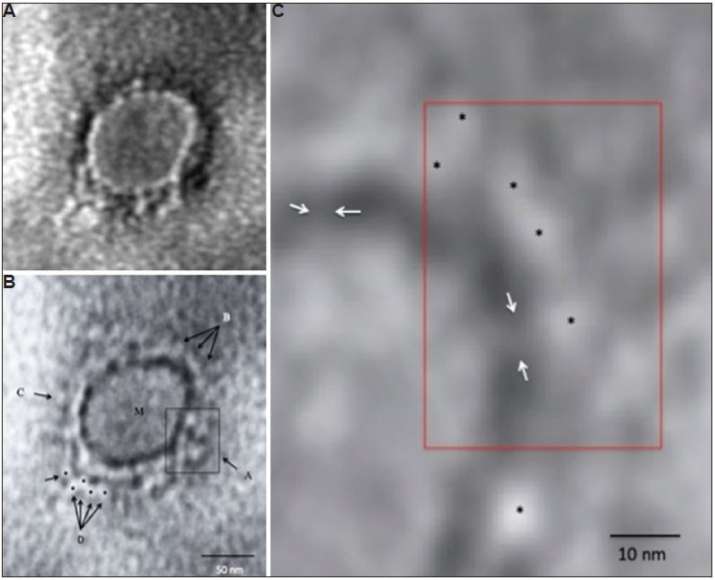 Transmission electron microscopy imaging of COVID-19.