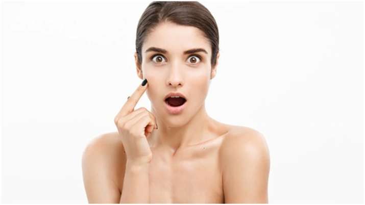 Probiotics an effective alternative to treat acne, finds