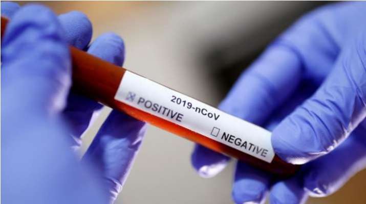 Fast, sensitive antibody blood test for COVID-19 developed