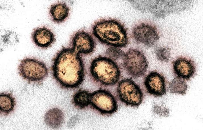 5-year-old boy dies from rare inflammatory illness linked to COVID-19 in US