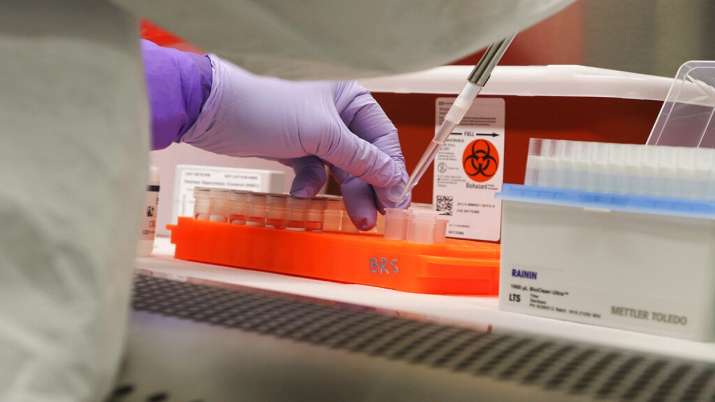 Coronavirus found in semen concerns of sexual transmission China ...