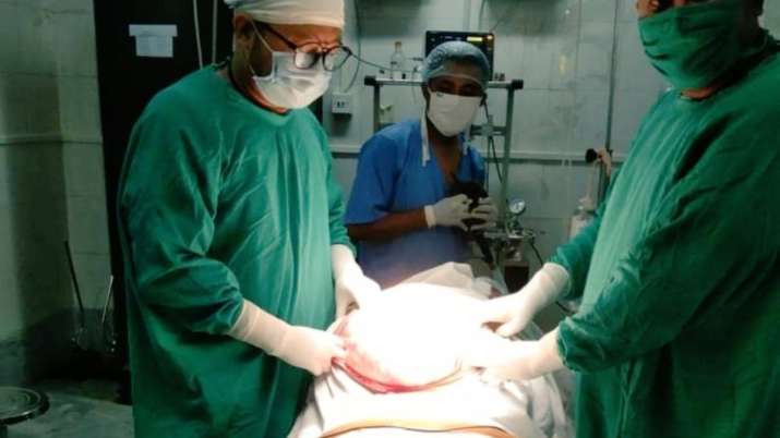 Meghalaya: Doctors remove 24-kg tumour from woman's abdomen; CM Sangma wishes speedy recovery