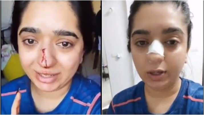 Zomato delivery man, accused by Bengaluru woman of an assault, filed an FIR against her at the same police station where she registered case against him.