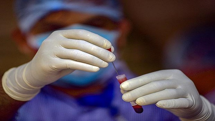 Despite surge in Covid cases, pandemic under control but