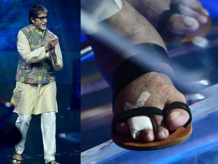 KBC13: Amitabh Bachchan Shares Pics Of His 'broken' Toe, Continues To ...