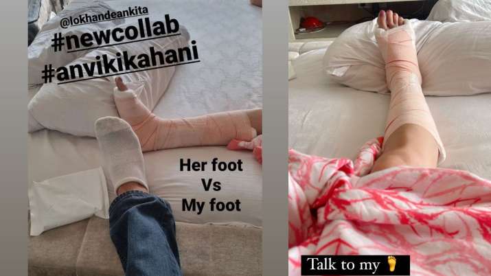 India Tv - Ankita Lokhande injured her leg ahead of her wedding