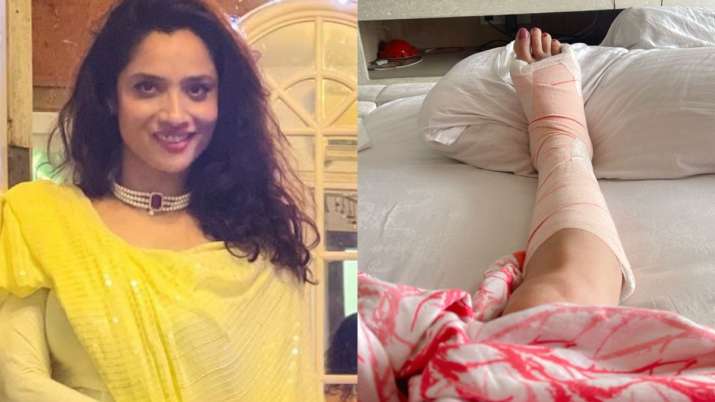 Ankita Lokhande injured her leg ahead of her wedding