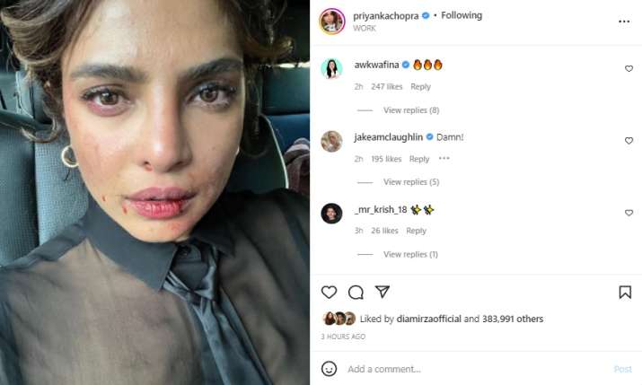India Tv - Comments on Priyanka Chopra's picture
