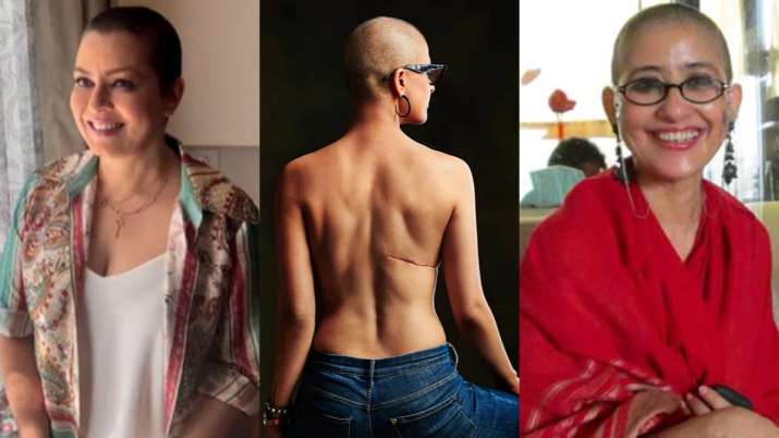 Bollywood actresses diagnosed with cancer: Mahima Chaudhry, Kirron Kher, Sonali Bendre & more