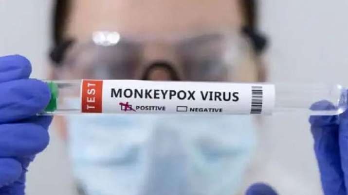 Suspected monkeypox case reported from UP; samples sent for further testing - Vimarsana News