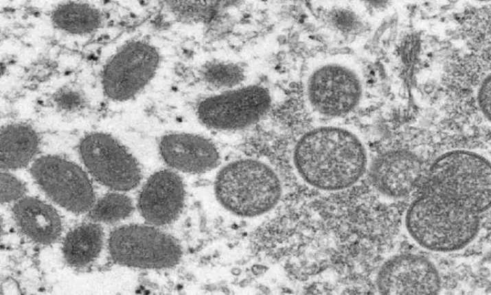 Monkeypox second case detected in Kerala's Kannur, India's tally rises to two - Vimarsana News