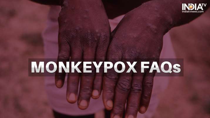 Monkeypox FAQs: Are tests available for diagnosis? Is the viral disease serious and fatal? - Vimarsana News